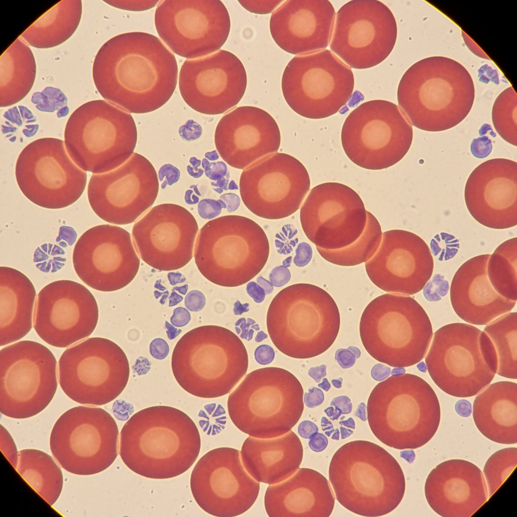 Czerwone krwinki i płytki krwi pod mikroskopem, obraz ukazujący mechanizm działania klopidogrelu