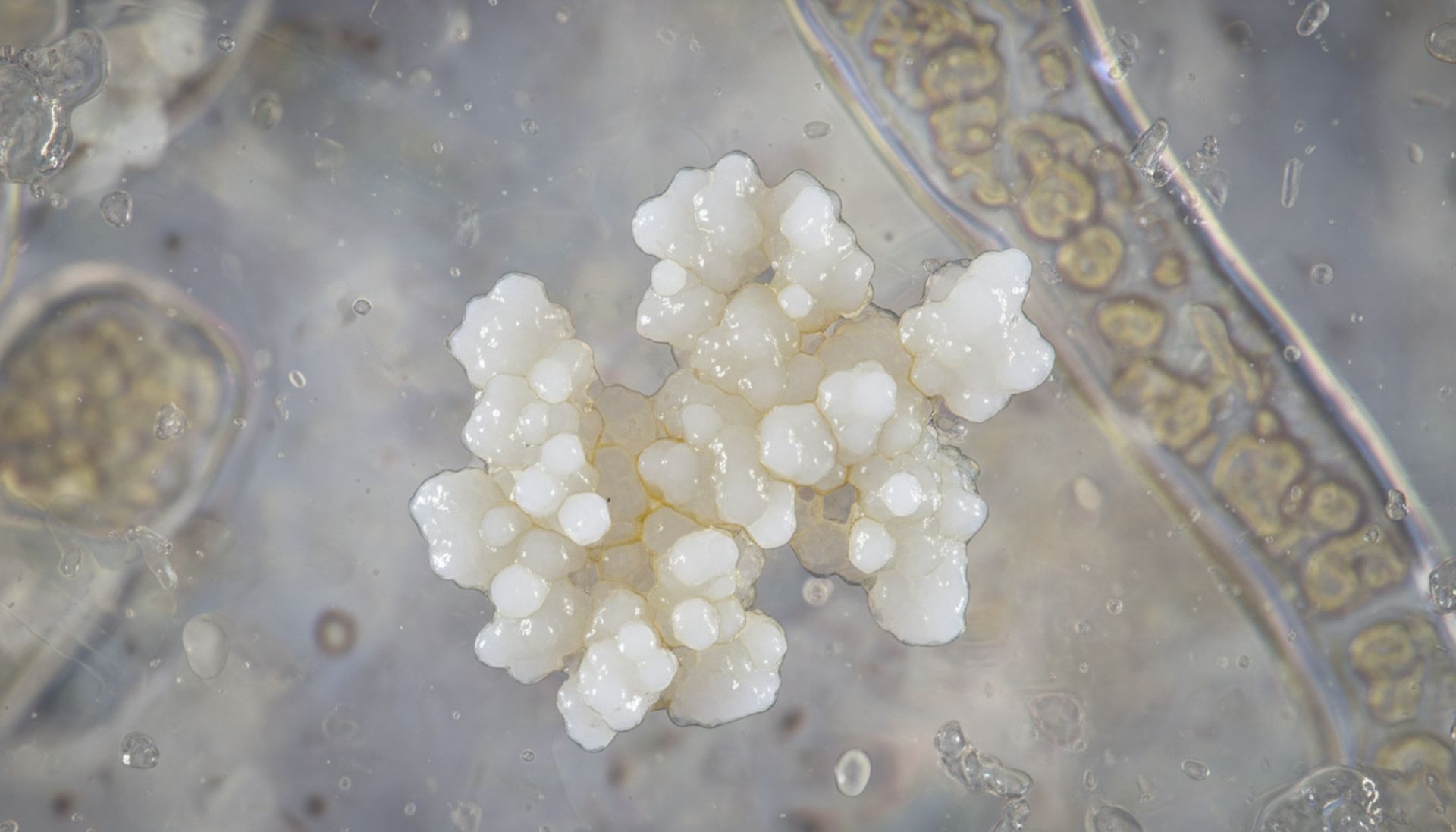 Fosfatydyloseryna: brutalna prawda, której nikt nie chce ci zdradzić