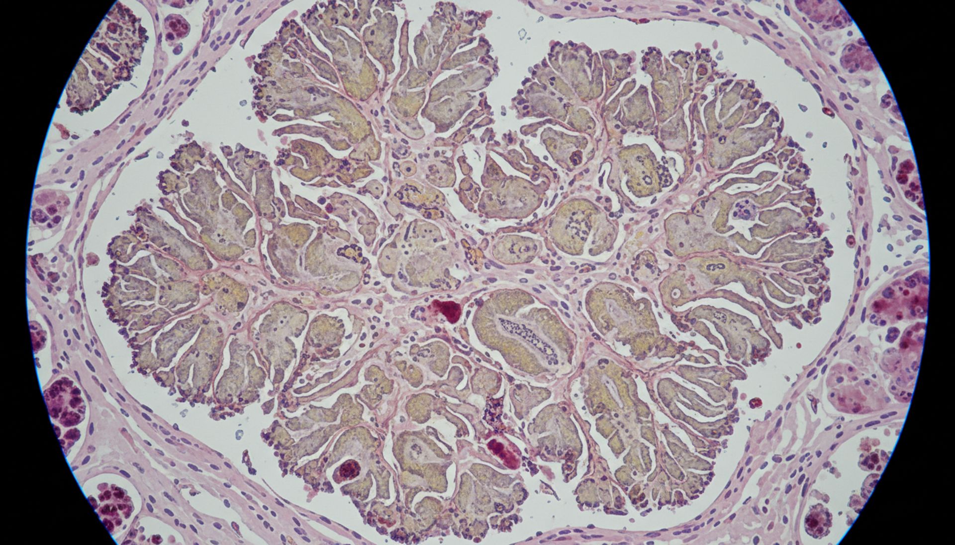 Rak endometrium: fakty, które zmienią twoje spojrzenie na kobiece zdrowie