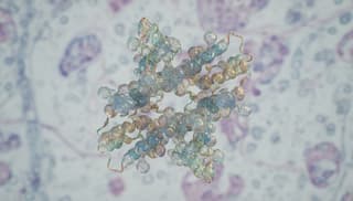Immunoglobuliny między życiem a rynkiem – fakty, mity, koszty