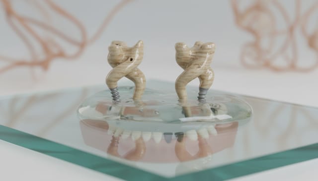 Implanty personalizowane: rewolucja, która zmienia zasady gry w medycynie