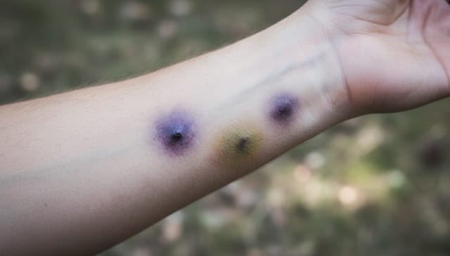 Siniaki: brutalna prawda, której nie chcesz znać