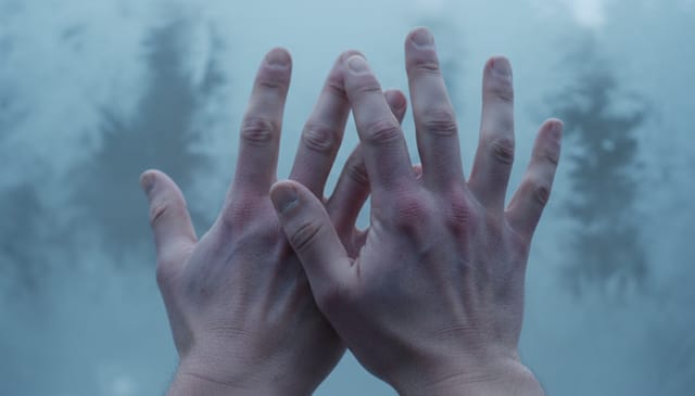 Zespół Raynauda: brutalna rzeczywistość zimnych dłoni i nie tylko