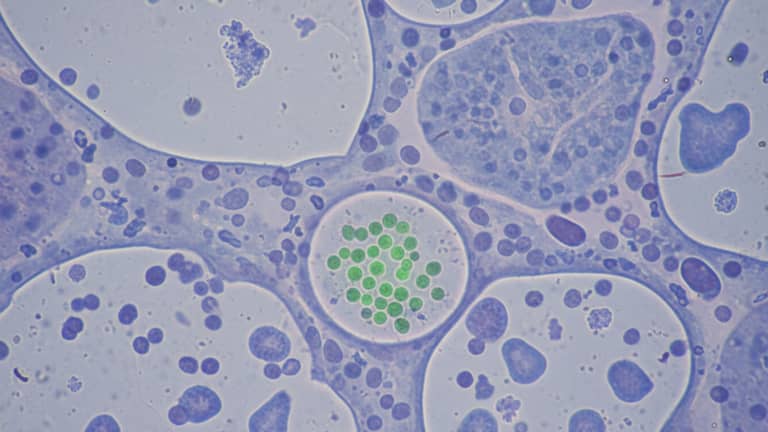 Chlamydia w Polsce: cicha infekcja, która odbiera płodność