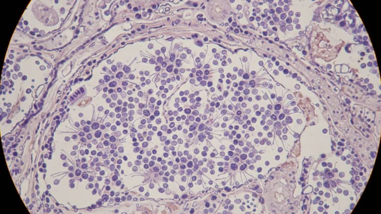Neuroblastoma u dzieci: objawy, błędy w diagnozie, realne szanse