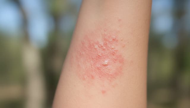 Atopia w psychologii: zrozumieć i radzić sobie z poczuciem wyobcowania