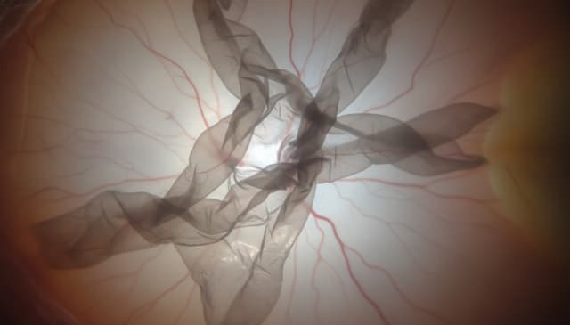 Błona nasiatkówkowa: kompleksowy przewodnik po funkcjach i znaczeniu