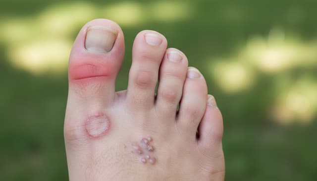 How boty symptom checker helps simplify your health assessments