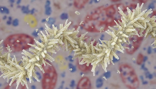 Jak rozpoznać i leczyć dna moczanowa: praktyczny przewodnik