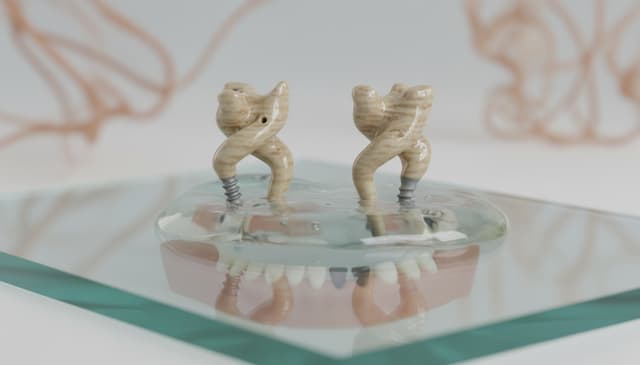 Implanty personalizowane: kompleksowy przewodnik po nowoczesnych rozwiązaniach