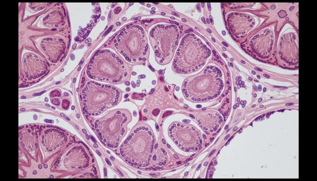 Kłębuszkowe zapalenie nerek: kompleksowy przewodnik dla pacjentów