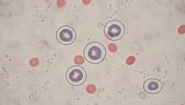 Limfocyty: jak wpływają na zdrowie psychiczne i odporność organizmu