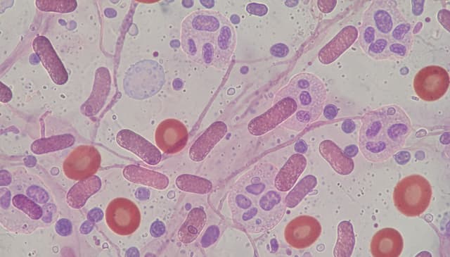 Meningokoki: co warto wiedzieć o zakażeniach i profilaktyce