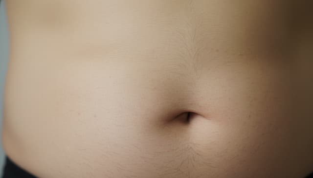 Przepuklina: kompleksowy przewodnik po przyczynach i leczeniu