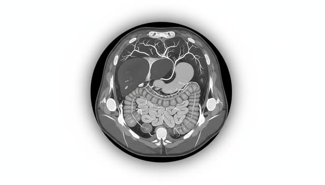 Tomografia brzucha: jak przebiega badanie i kiedy jest potrzebna