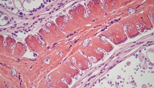 Zapalenie szyjki macicy: przyczyny, objawy i metody leczenia