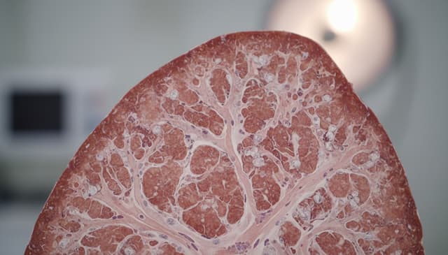 Zwłóknienie płuc: kompleksowy przewodnik po przyczynach i leczeniu