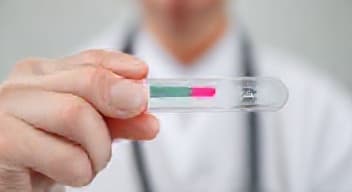 Wytłumacz mi wyniki